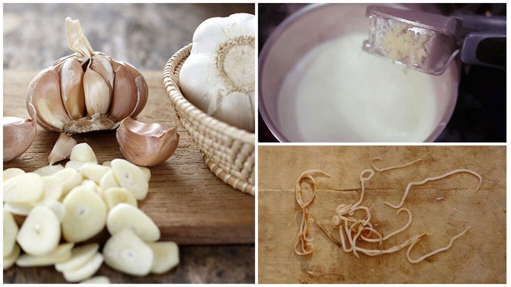 Milk with garlic - a folk remedy for worms in children