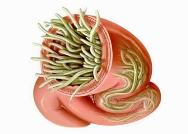 The type of parasites in the human body