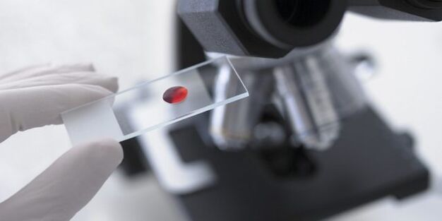 blood test