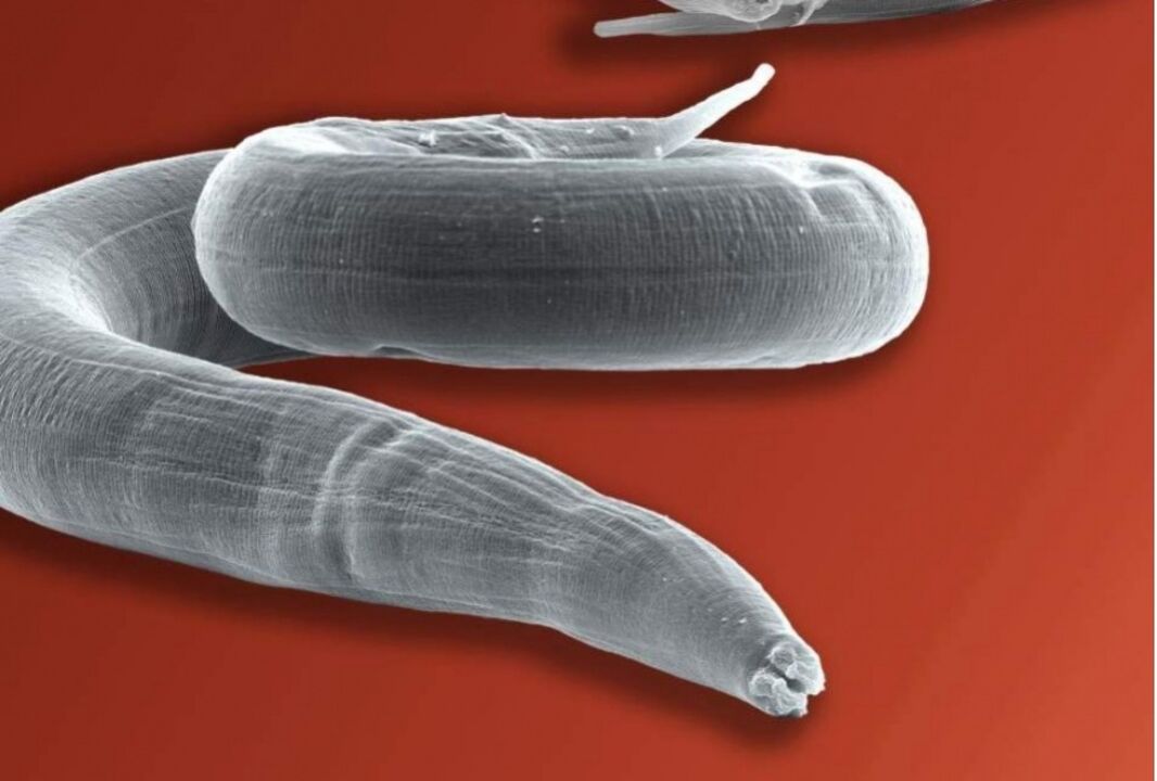 pinworms from the human body