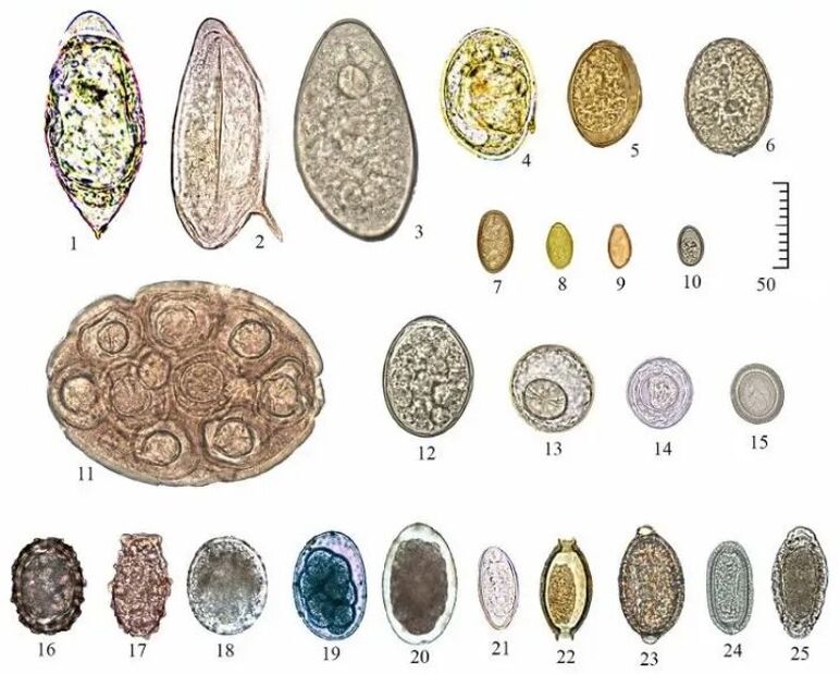 shape and size of eggs of different helminths