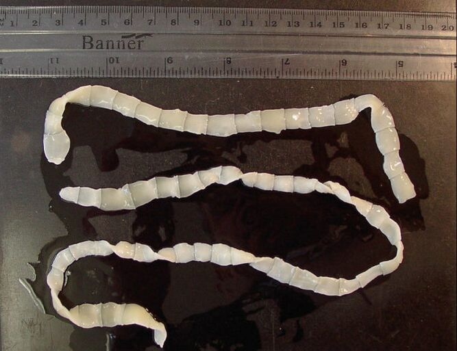 Wide tapeworm